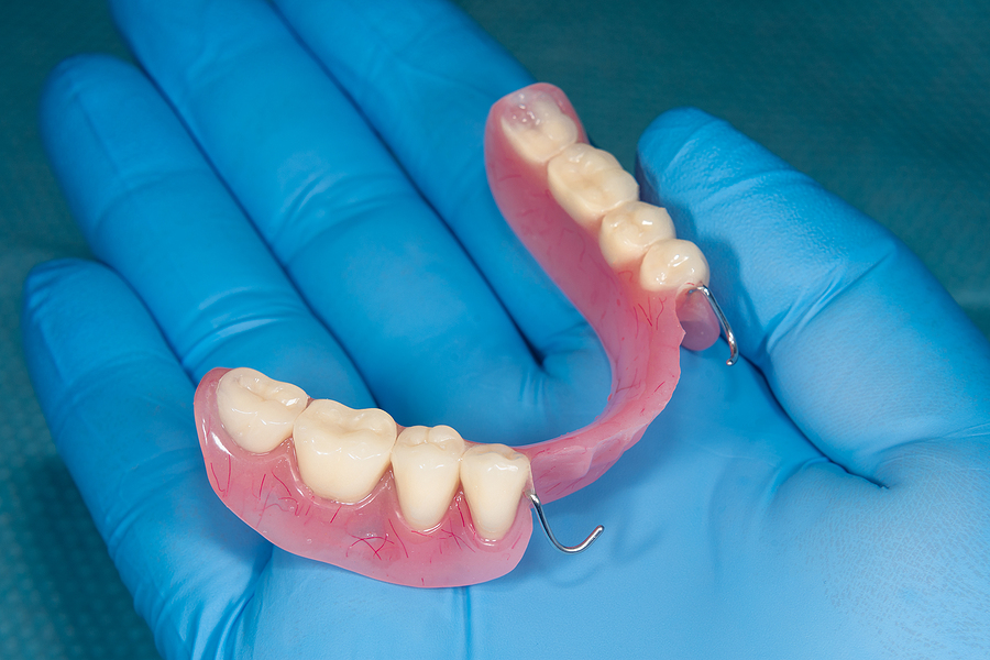 Consider an Effective and Affordable RPD for Teeth Replacement