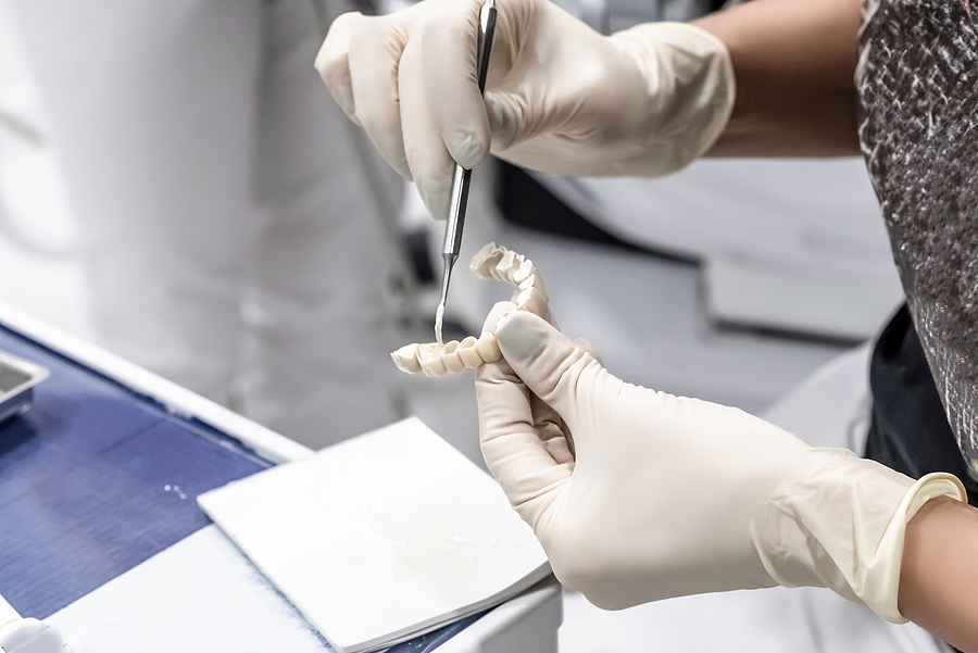 Cemented or Screwed: Which Implant Crown Attachment is Best for You?