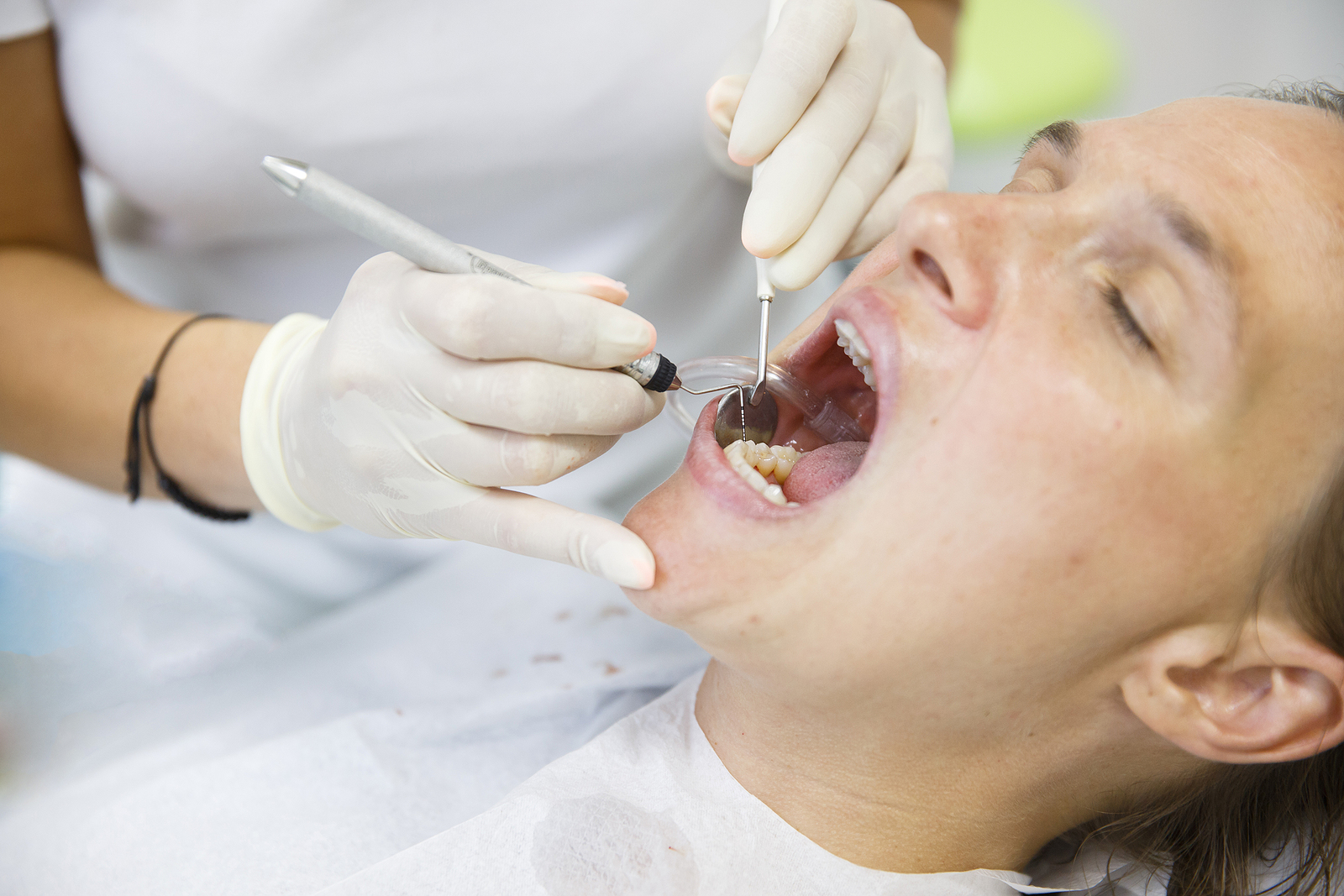 Smile Brighter: The Crucial Role of Routine Cleanings in Preventative Dentistry