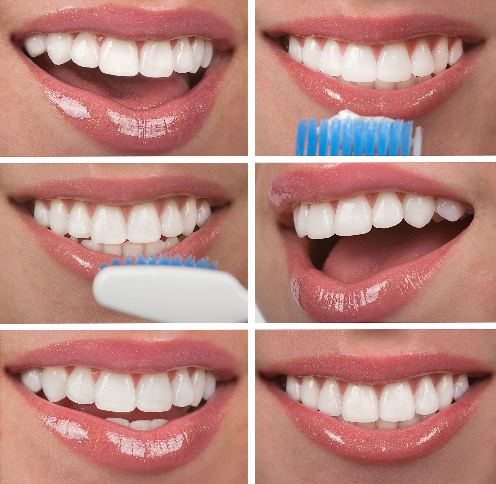 Transform Your Smile with Porcelain Veneers in Mission Viejo, CA: The Ultimate Guide